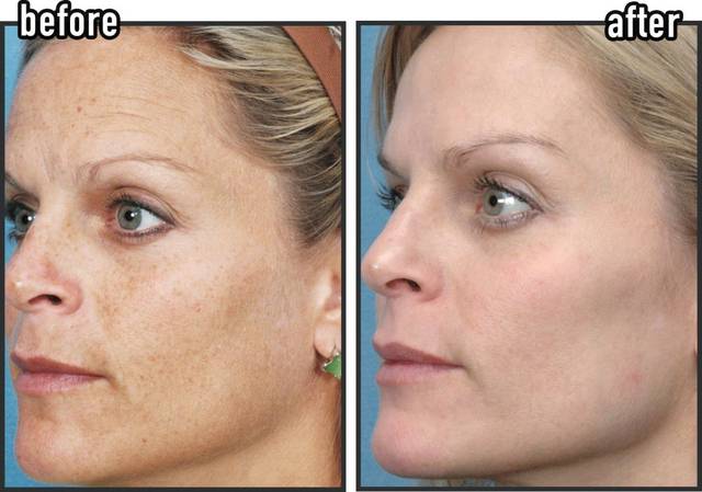 Revitalizing Firming Eye Cream |Powerful Wrinkle Smoothing