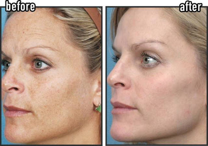 Revitalizing Firming Eye Cream |Powerful Wrinkle Smoothing