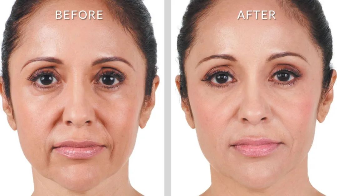 Revitalizing Firming Eye Cream |Powerful Wrinkle Smoothing
